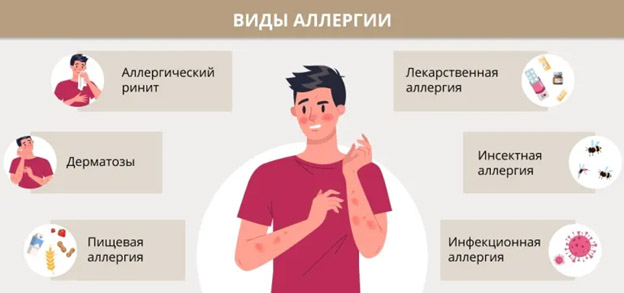 allergiya statya