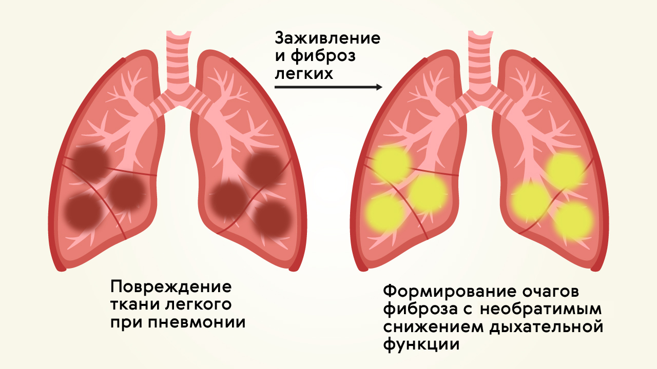 l2